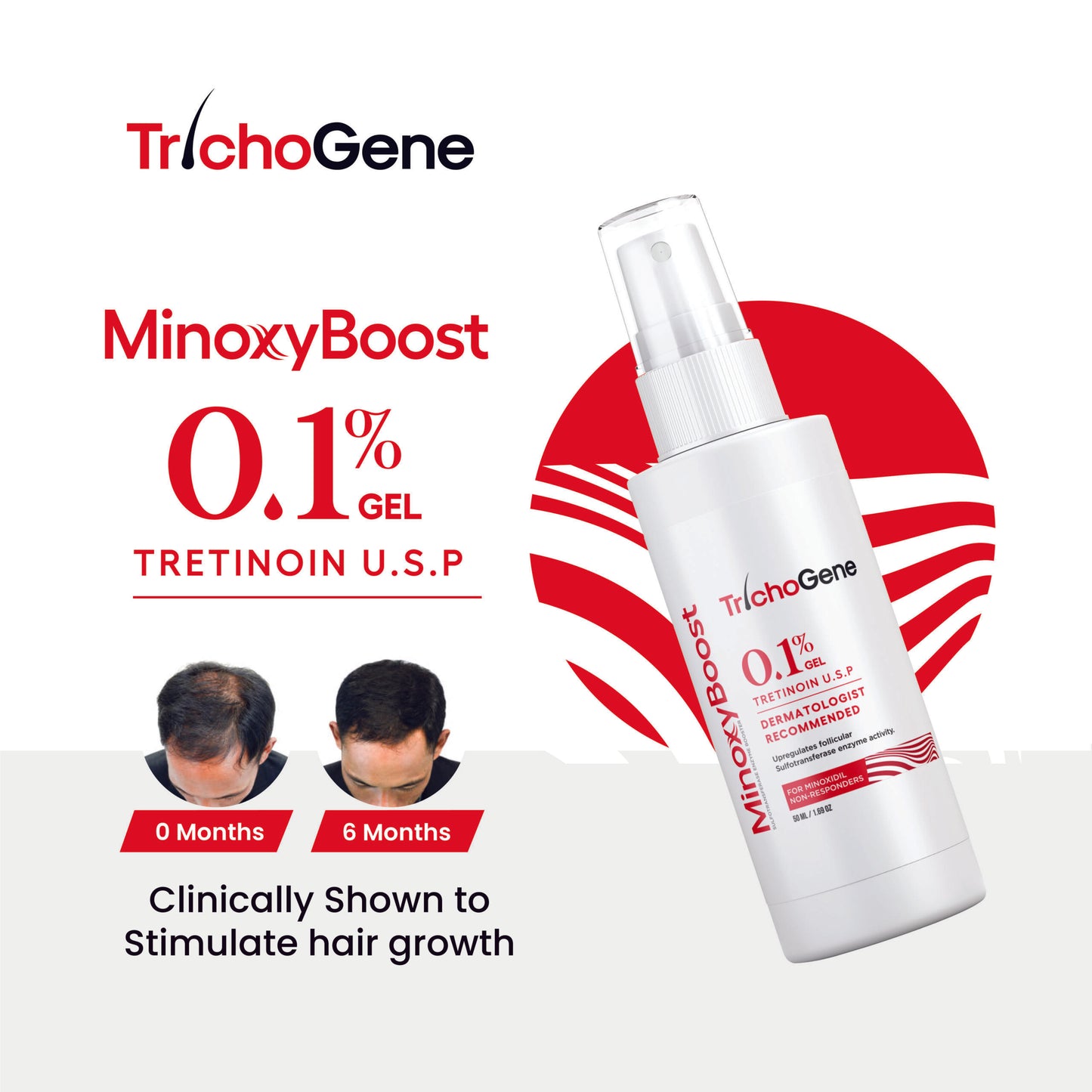 TrichoGene MinoxyBoost|Minoxidil Booster |(for Minoxidil Non-Responders)